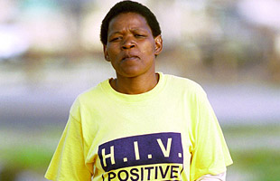 HIV